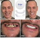 Snap-On Instant Perfect Smile Veneers Comfortable Flex Fit Dentures for Top & Bottom Teeth White Tooth Cosmetic Cover PACK OF 1
