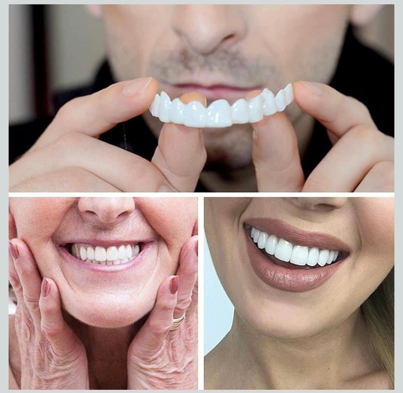 Snap-On Instant Perfect Smile Veneers Comfortable Flex Fit Dentures for Top & Bottom Teeth White Tooth Cosmetic Cover PACK OF 1