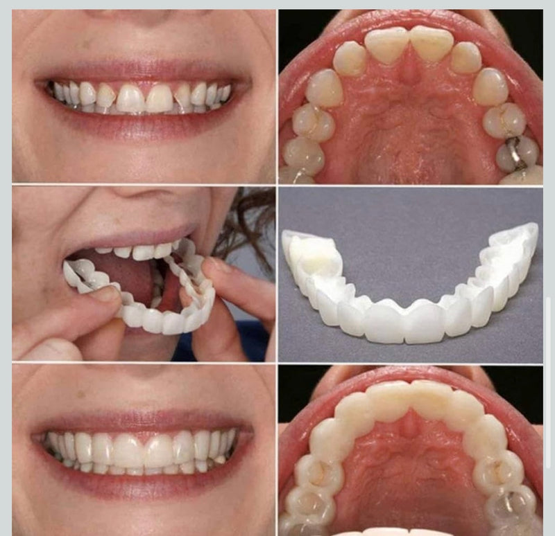 Snap-On Instant Perfect Smile Veneers Comfortable Flex Fit Dentures for Top & Bottom Teeth White Tooth Cosmetic Cover PACK OF 1